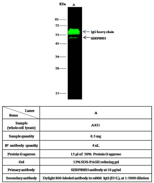Anti-Human SERPINB3 Antibody [B363] - ABMIUM