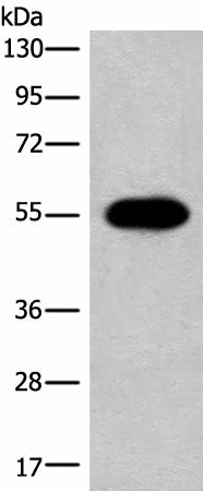Western blot analysis of A549 cell lysate using HAS3 Polyclonal Antibody at dilution of 1:300