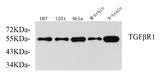 Western Blot analysis of various samples using TGF β Receptor I Polyclonal Antibody at dilution of 1:750.
