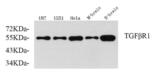 Western Blot analysis of various samples using TGF β Receptor I Polyclonal Antibody at dilution of 1:750.