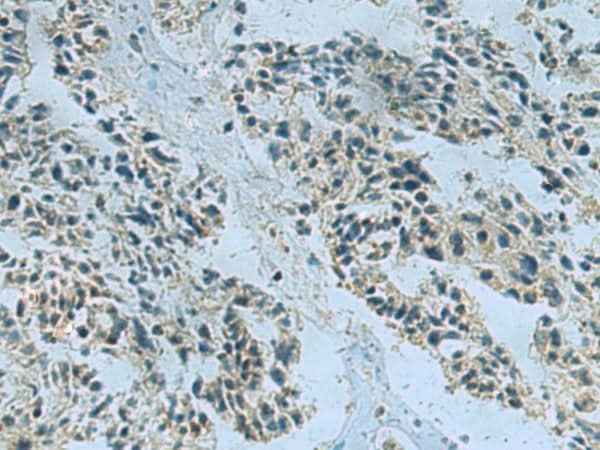 Anti-Human NDUFA2 Antibody
