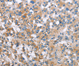 Anti-Human/Mouse/Rat MCL1 Antibody - ABMIUM