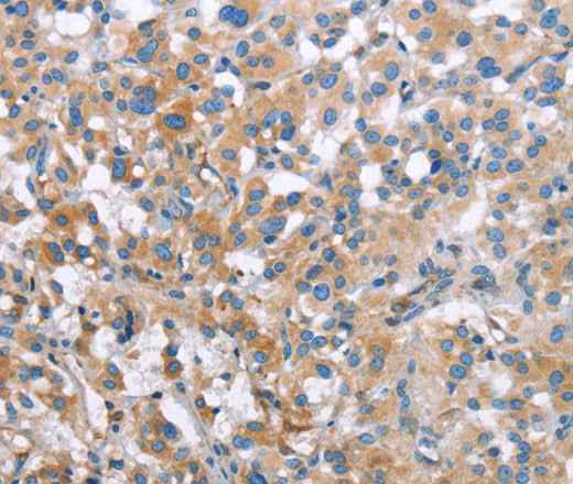 Anti-Human/Mouse/Rat MCL1 Antibody