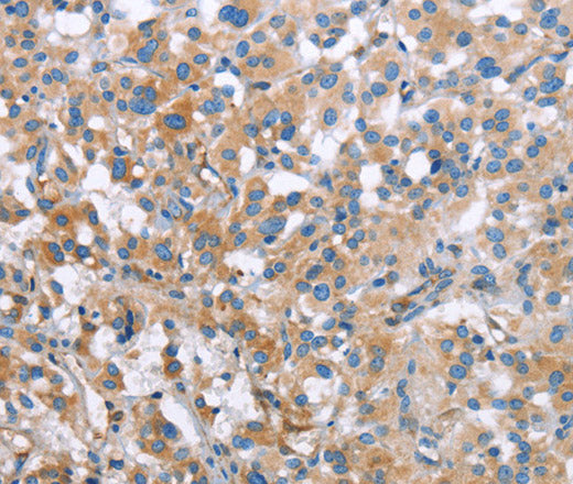 Anti-Human/Mouse/Rat MCL1 Antibody - ABMIUM