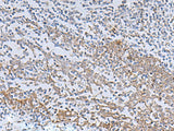 Immunohistochemistry of paraffin-embedded Human tonsil tissue using IL22RA2 Polyclonal Antibody at dilution of 1:70(×200)