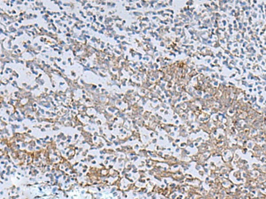 Immunohistochemistry of paraffin-embedded Human tonsil tissue using IL22RA2 Polyclonal Antibody at dilution of 1:70(×200)
