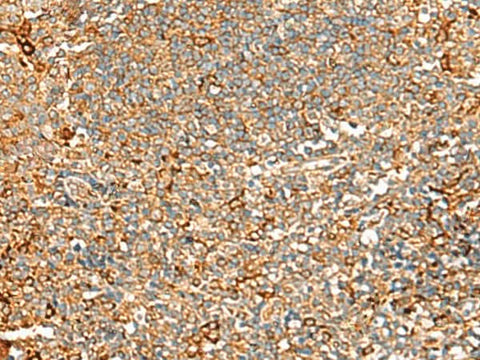 Immunohistochemistry of paraffin-embedded Human tonsil tissue using ASMTL Polyclonal Antibody at dilution of 1:100(×200)