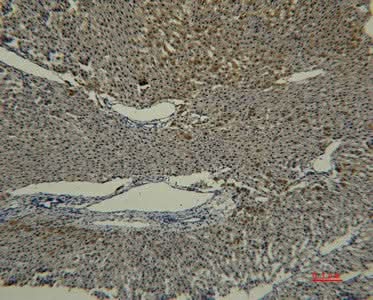 Immunohistochemistry of paraffin-embedded Rat liver tissue using Transferrin Monoclonal Antibody at dilution of 1:50.