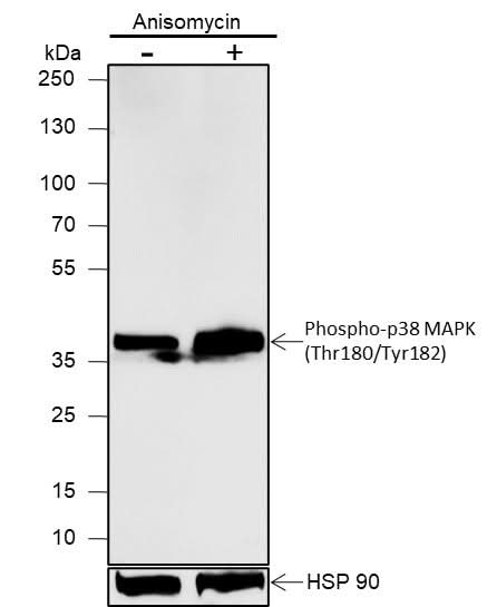 Anti-Human/Rat/Mouse Phospho-p38 MAPK (Thr180, Tyr182) Antibody [A814] - ABMIUM