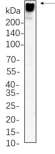 Anti-Human/Mouse/Rat MAP2 Antibody [B564] - ABMIUM