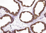 Anti-Human NPC2 Antibody [A1165] - ABMIUM