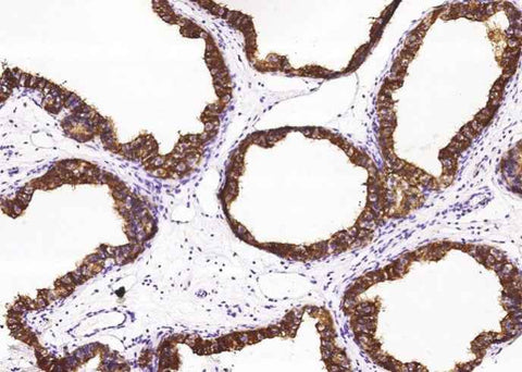 Anti-Human NPC2 Antibody [A1165] - ABMIUM