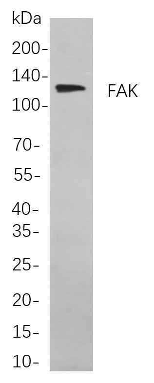 Anti-Human/Mouse/Rat FAK Antibody [B787] - ABMIUM