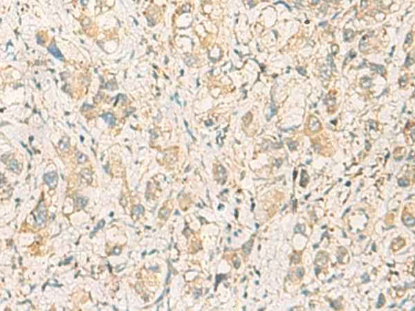 Anti-Human F11R Antibody