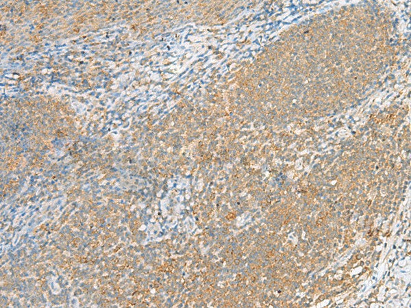 Immunohistochemistry of paraffin-embedded Human tonsil tissue using FOLR1 Polyclonal Antibody at dilution of 1:80(×200)