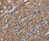 Anti-Human NAA25 Antibody - ABMIUM