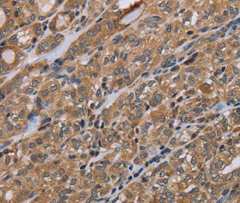 Anti-Human NAA25 Antibody