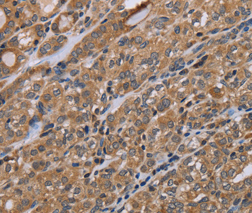 Anti-Human NAA25 Antibody - ABMIUM