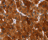 Anti-Human/Mouse/Rat HSPB6 Antibody - ABMIUM
