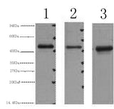 Western Blot analysis of 1) 293T, 2) HepG2, 3) Hela cells using FH Monoclonal Antibody at dilution of 1:3000.