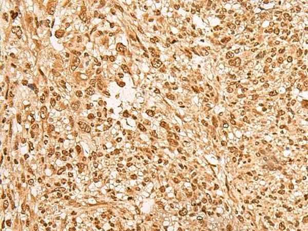 Anti-Human JPT2 Antibody