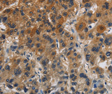 Anti-Human CLDN8 Antibody - ABMIUM