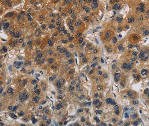 Anti-Human CLDN8 Antibody
