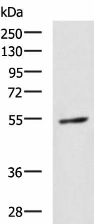 Western blot analysis of 231 cell lysate using GBA Polyclonal Antibody at dilution of 1:1350