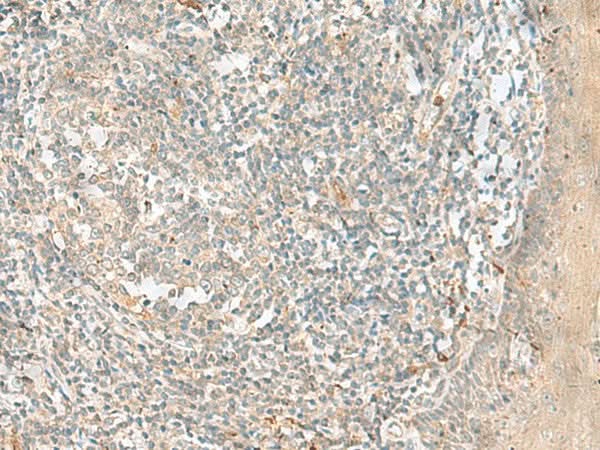 Immunohistochemistry of paraffin-embedded Human tonsil tissue using TTLL1 Polyclonal Antibody at dilution of 1:90(×200)