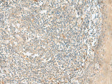 Immunohistochemistry of paraffin-embedded Human tonsil tissue using TTLL1 Polyclonal Antibody at dilution of 1:90(×200)