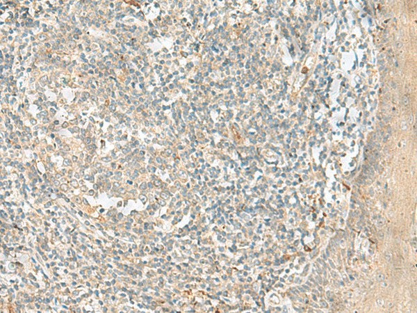 Immunohistochemistry of paraffin-embedded Human tonsil tissue using TTLL1 Polyclonal Antibody at dilution of 1:90(×200)