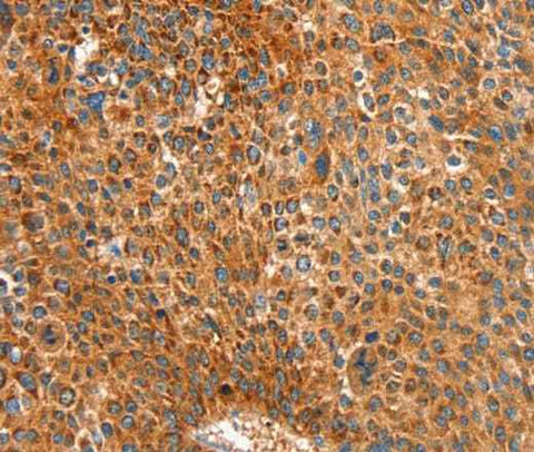 Anti-Human/Mouse/Rat ALDH1A2 Antibody