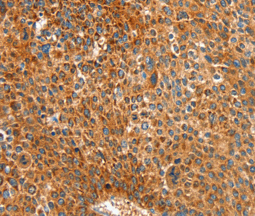 Anti-Human/Mouse/Rat ALDH1A2 Antibody - ABMIUM