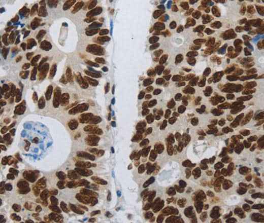 Anti-Human SLC16A14 Antibody