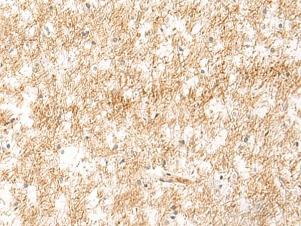 Immunohistochemistry of paraffin-embedded Human brain tissue using XPC Polyclonal Antibody at dilution of 1:25(×200)