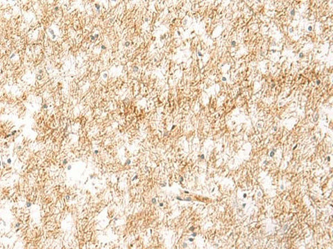 Immunohistochemistry of paraffin-embedded Human brain tissue using XPC Polyclonal Antibody at dilution of 1:25(×200)