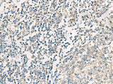 Immunohistochemistry of paraffin-embedded Human tonsil tissue using SERPINB4 Polyclonal Antibody at dilution of 1:40(×200)
