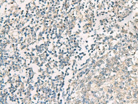 Immunohistochemistry of paraffin-embedded Human tonsil tissue using SERPINB4 Polyclonal Antibody at dilution of 1:40(×200)