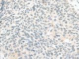 Anti-Human/Mouse/Rat ELOC Antibody - ABMIUM