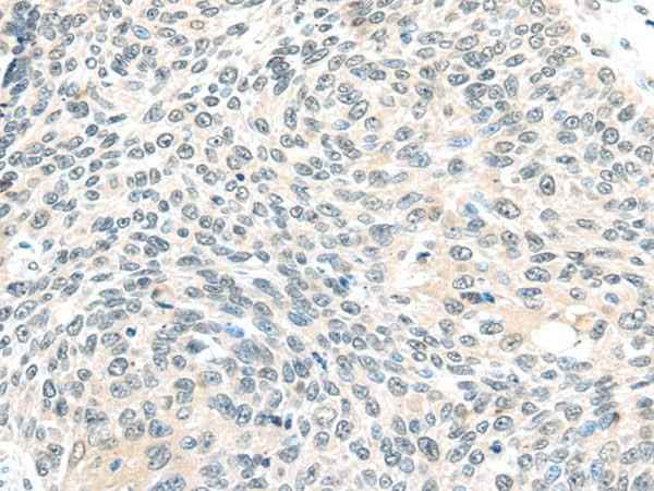 Anti-Human/Mouse/Rat ELOC Antibody