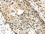 Anti-Human/Mouse/Rat TALDO1 Antibody - ABMIUM