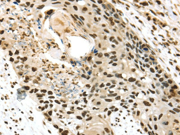 Anti-Human/Mouse/Rat TALDO1 Antibody - ABMIUM