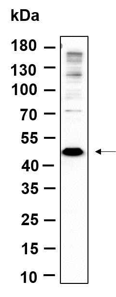 Anti-Human/Mouse/Rat Methionyl Aminopeptidase 1 Antibody [B1002] - ABMIUM