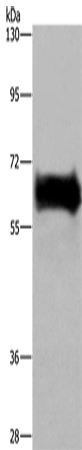 Anti-Human/Mouse/Rat EZR Antibody - ABMIUM