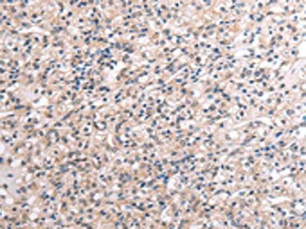 Anti-Human/Mouse RNF115 Antibody