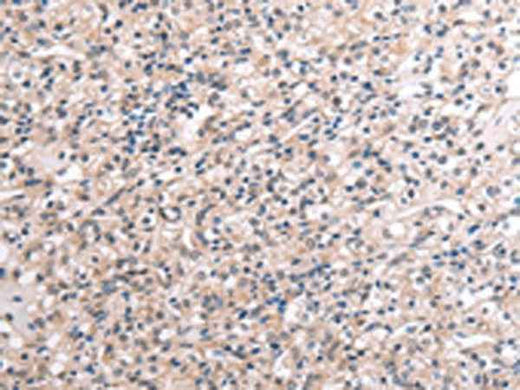 Anti-Human/Mouse RNF115 Antibody