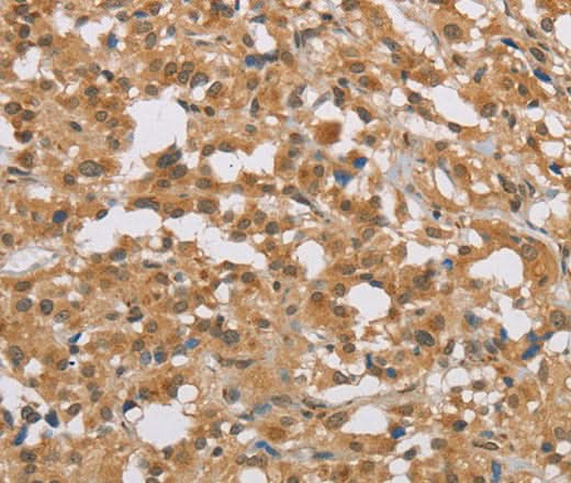 Anti-Human DIDO1 Antibody - ABMIUM