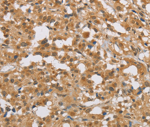 Anti-Human DIDO1 Antibody - ABMIUM