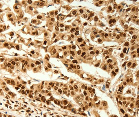 Anti-Human C12orf5 Antibody - ABMIUM