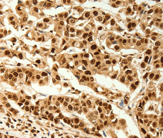 Anti-Human C12orf5 Antibody - ABMIUM